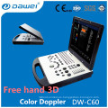 Precio de la máquina del eco de DW-C60 2d, precio del ultrasonido del doppler del color de la computadora portátil